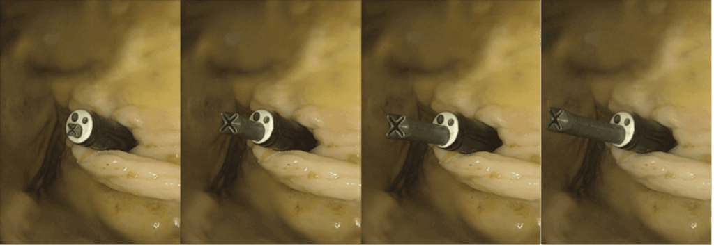 Pressure-free growing robots for soft medical robotics